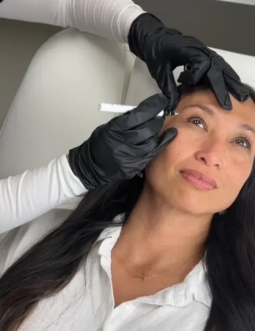 Mindy Jackson marking injection sites with marker on patients face